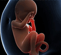 试管婴儿适合子宫内膜异位症患者吗?