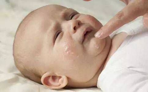 新生儿如何预防湿疹？新生宝宝得湿疹如何护理