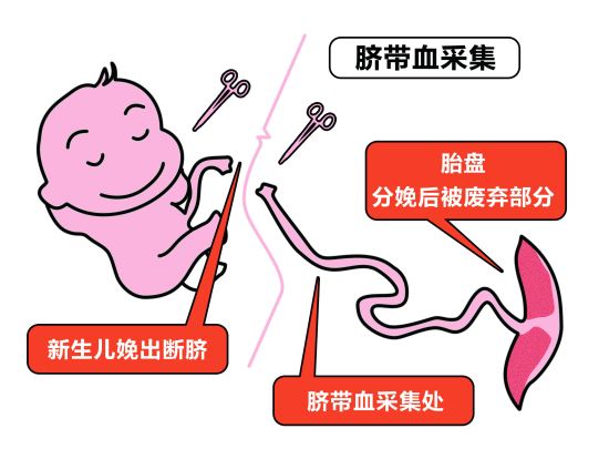 据说脐带血能治疗很多疾病！真有必要保存脐带血吗