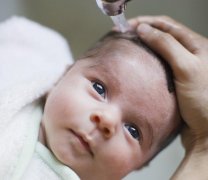 新生儿脸上有小红点怎么办？是宝宝湿疹吗